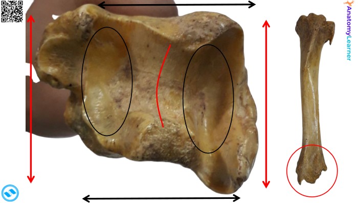 Distal part of the animals tibia
