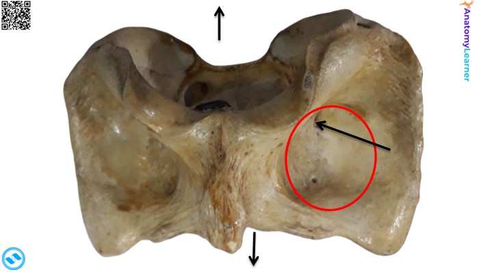 Ox atlas bone ventral view