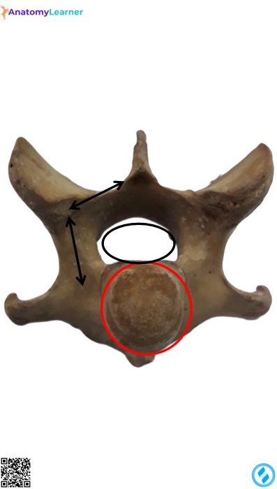 Typical vertebra anterior view